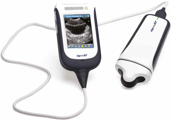 hand-held, ultrasound, device